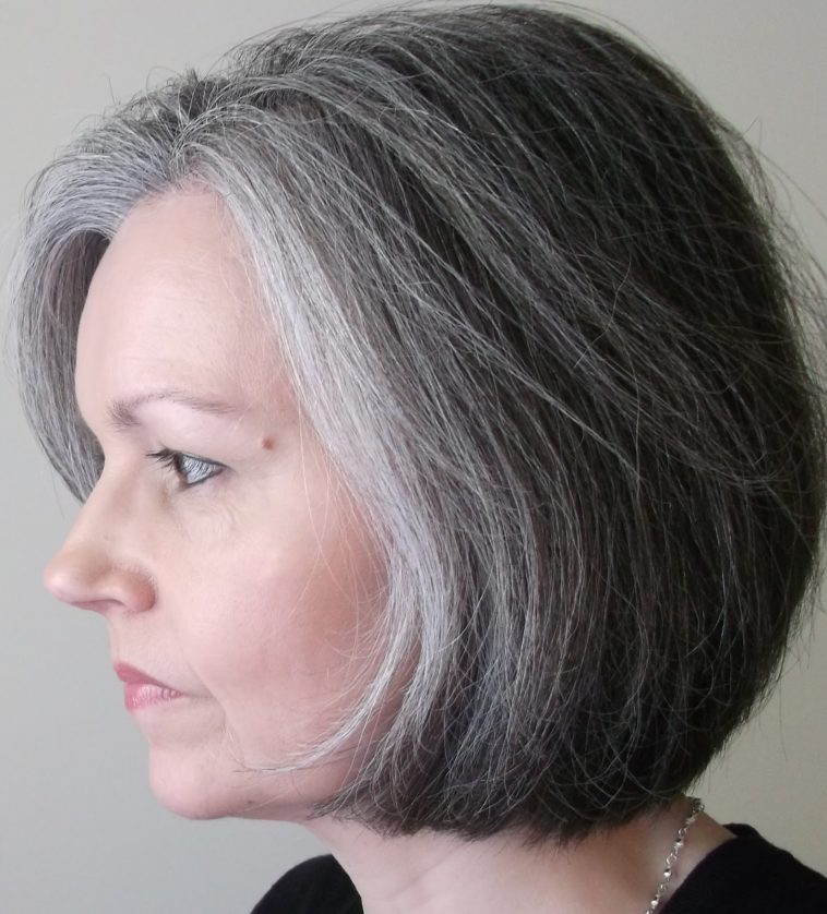 Friends Making Fun Of Your Gray Hairs At An Early Age Make Your
