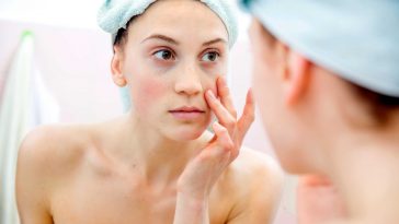 10-tips-to-reduce-under-eye-puffiness