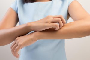 10-ways-to-deal-with-rashes