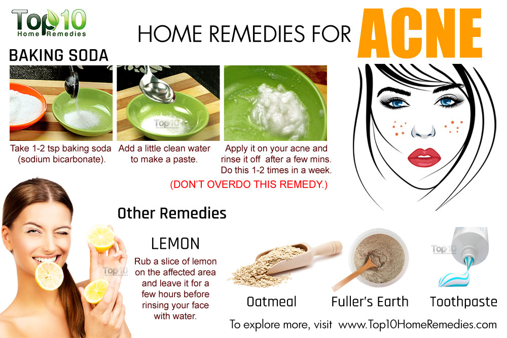 10 Remedies To Get Rid Of Severe Acne SmuGG BuGG